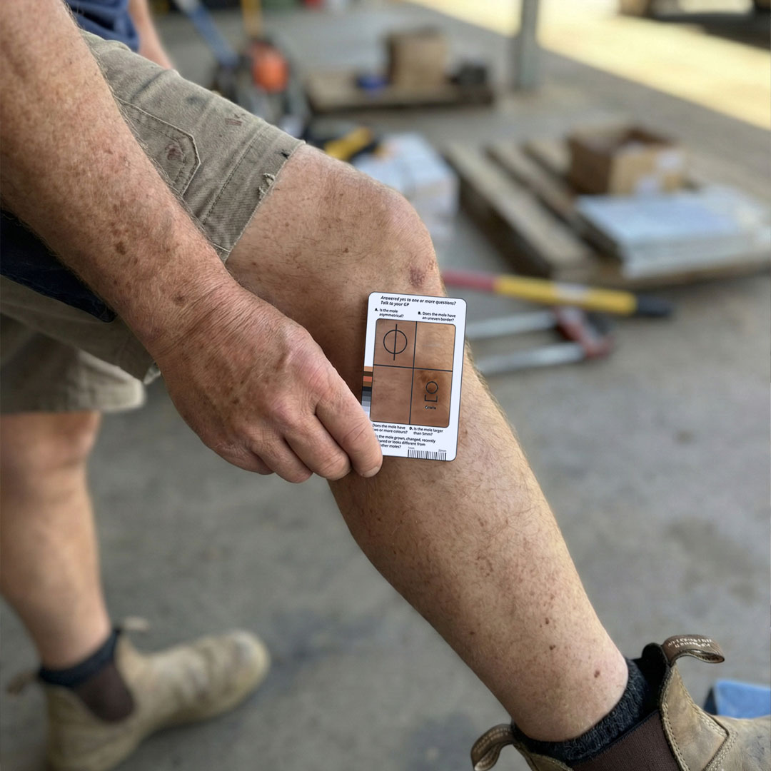 Employee using the Skin Check Card